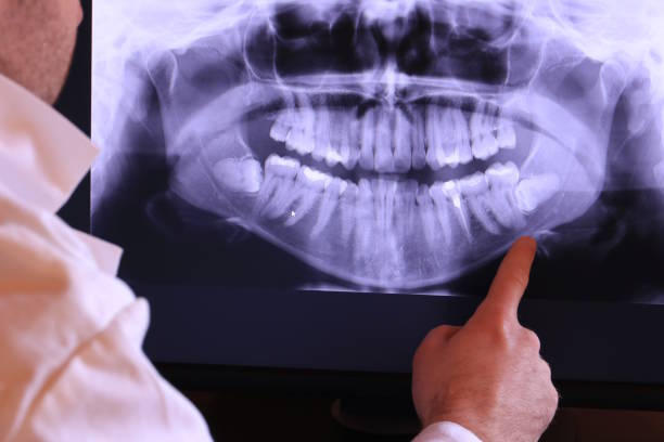 Best Emergency Gum Pain Relief  in New Franklin, MO