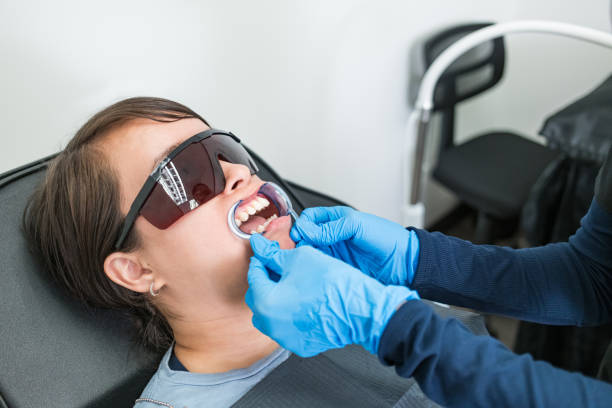 Best Teeth Whitening  in New Franklin, MO